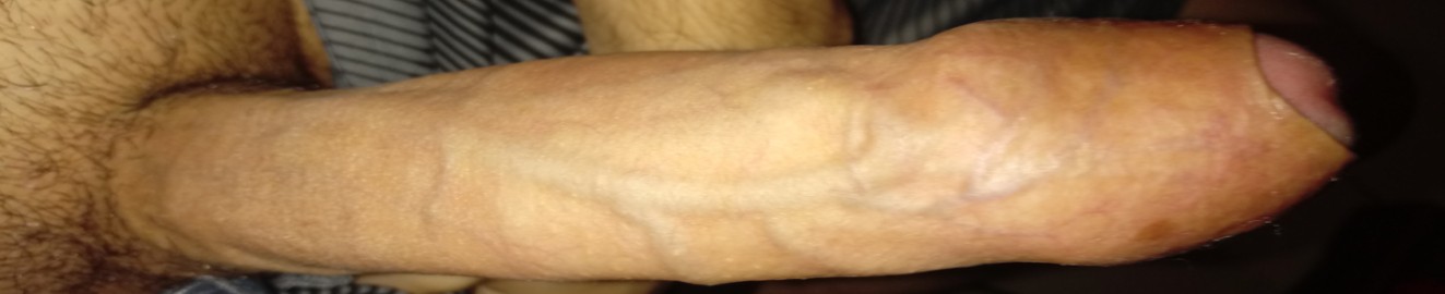 PancitaDeGecko