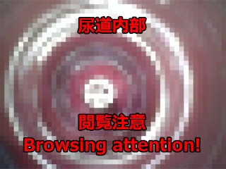 【閲覧注意】内視鏡で尿道オナニー。挿入中に潮吹きして、抜いた瞬間に水が吹き出す様子です。urethral Masturbation with an Endoscope.