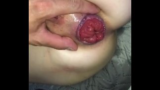 Anale dildo verzakking squirt grote kont